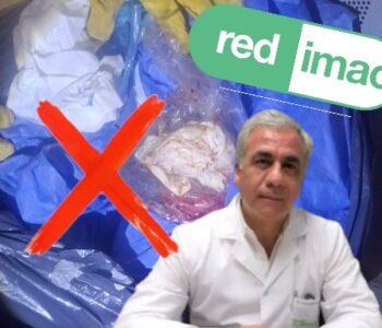 transparent-Photoroom (3)